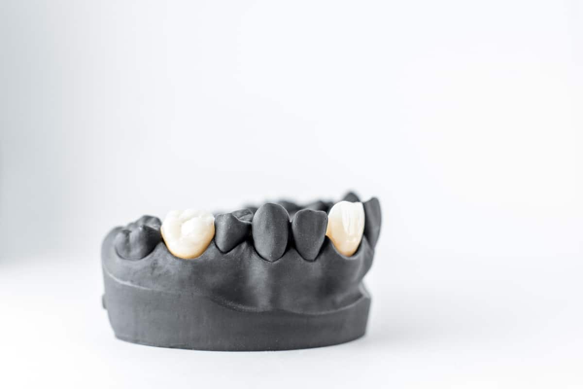 Dental Crown
