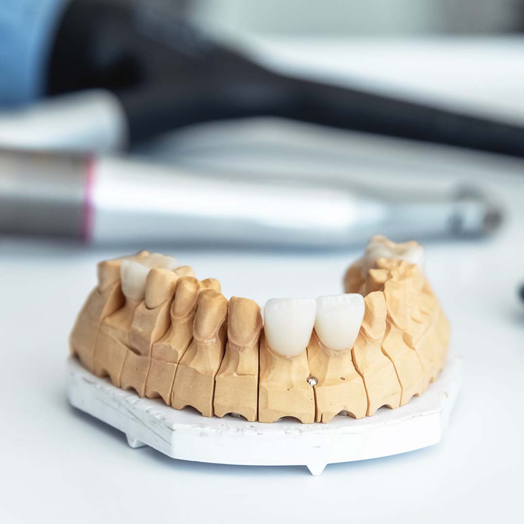 4 Advanced Dental Services We Offer - Primary Dental