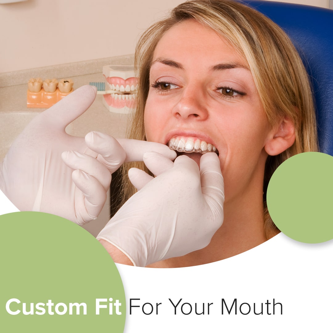 Young woman getting dental impressions taken with "Custom Fit For Your Mouth" text overlay in dental office.