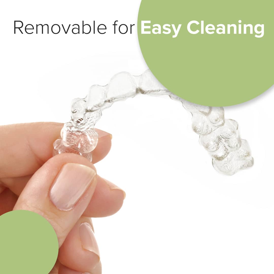 Hand holding clear removable dental aligner showing easy cleaning feature for orthodontic treatment.