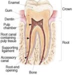 Anatomical cross-section diagram of tooth structure showing enamel, dentin, pulp, root, and bone layers.