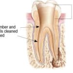 Tooth cross-section diagram showing internal anatomy with pulp chamber and root canals labeled.