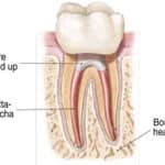 Anatomical cross-section diagram of tooth structure showing pulp, dentin, enamel, and roots.