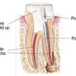 Anatomical cross-section diagram showing tooth structure, nerves, and blood vessels in dental tissue.