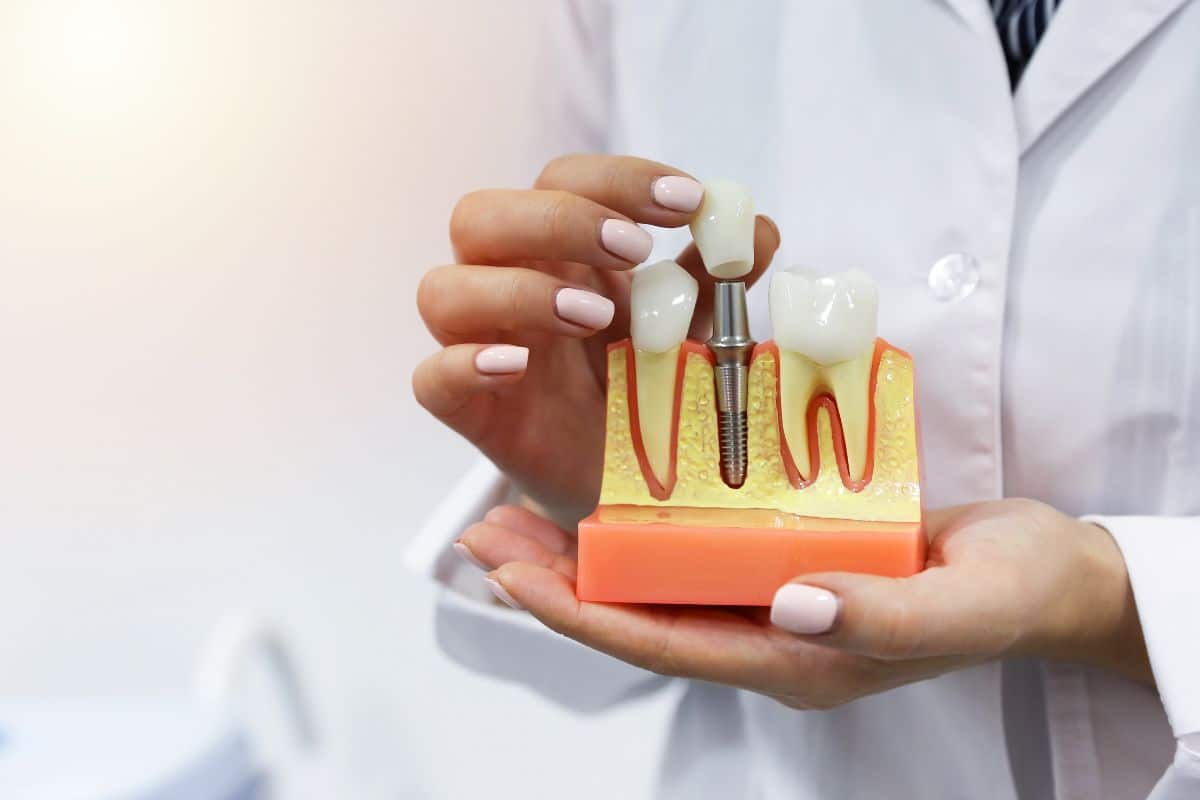 Loose Dental Implant
