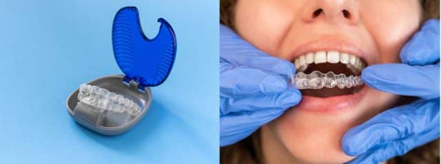 Invisalign Treatment Denver