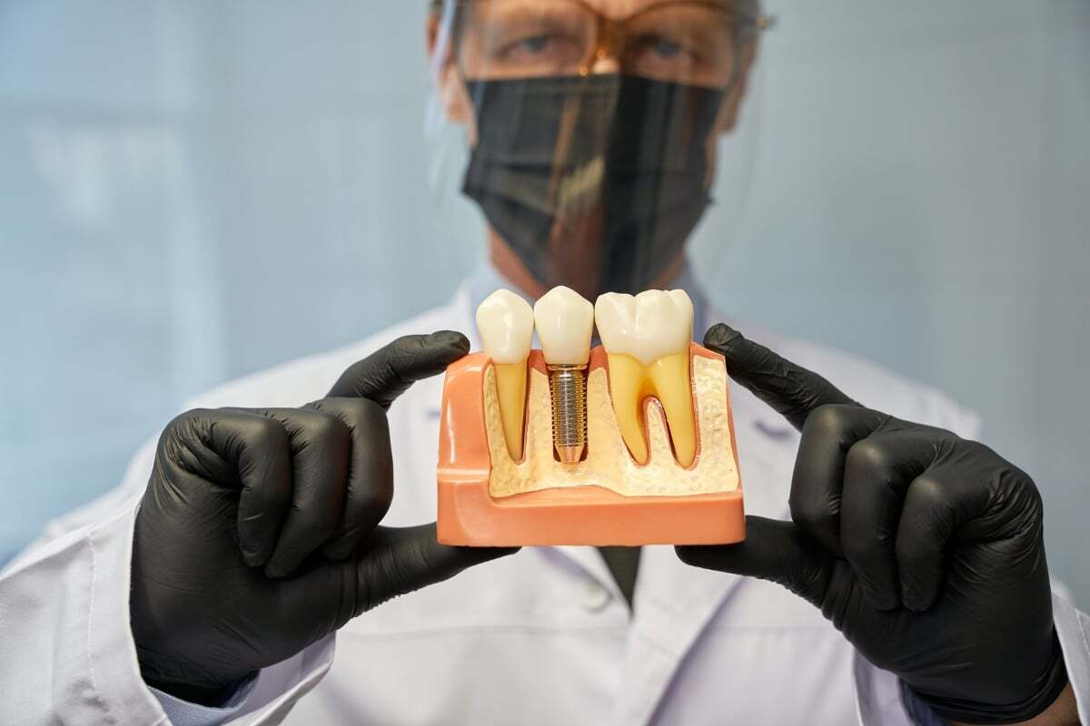 Dental implant model showing tooth replacement procedure at dental office in Denver, Colorado.