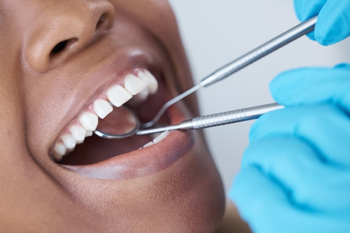 Dental hygienist examining patient's teeth during professional cleaning at practice in Denver, Colorado.